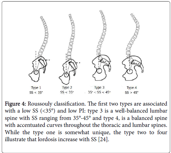 Evaluation of Effect of Posterior Dynamic Stabilization IntraSPIN